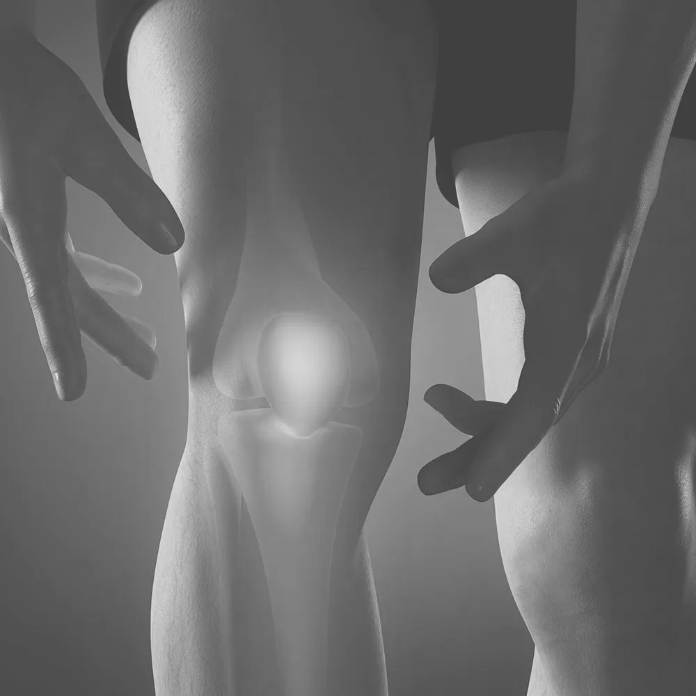 KNEE REPLACEMENT