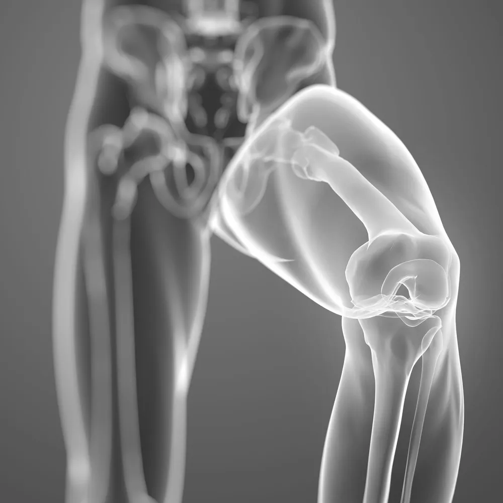 ACL RECONSTRUCTION